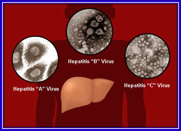 http://medical-iran.persiangig.com/image/Hepatits/Hepatit%201.jpg